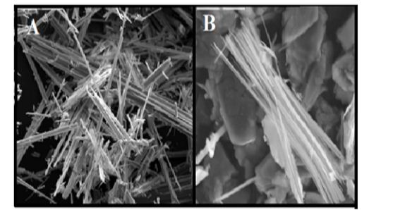 Discovering of Asbestos Fibers and Corn Starch in Talc Material of Baby Powder Samples from Different Markets in Benghazi City 